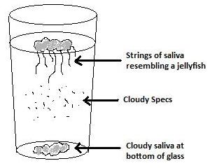 what the saliva test looks like when you have symptoms of candida overgrowth