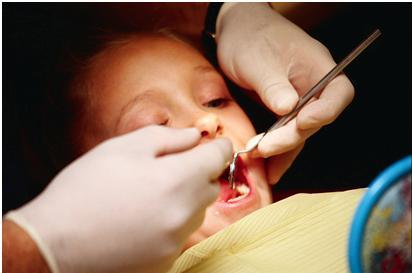 child with symptoms of oral defensiveness and dysfunction getting teeth cleaned while at the dentist